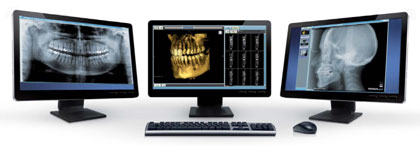 Cone Beam CT for Dental Applications